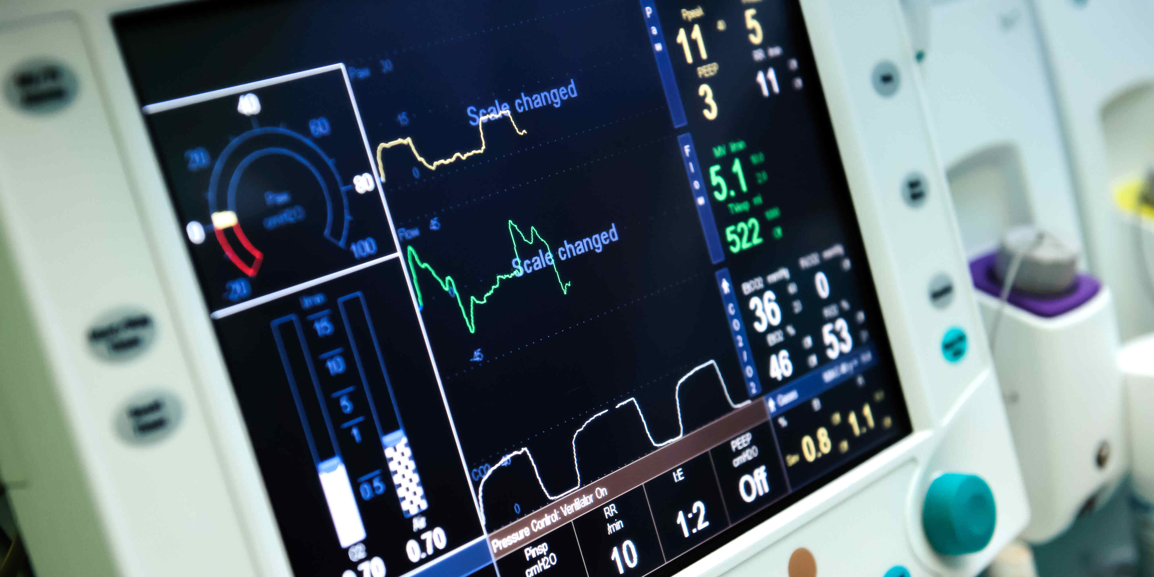 close up of a ventilator computer screen