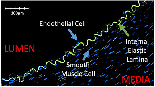 Graph of lumen to media with endothelial cell, smooth muscle cell and internal elastic lamina marked