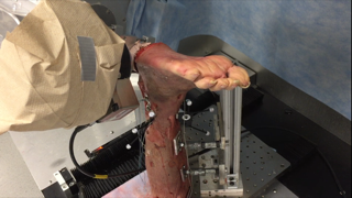 Ankle joint robotic test