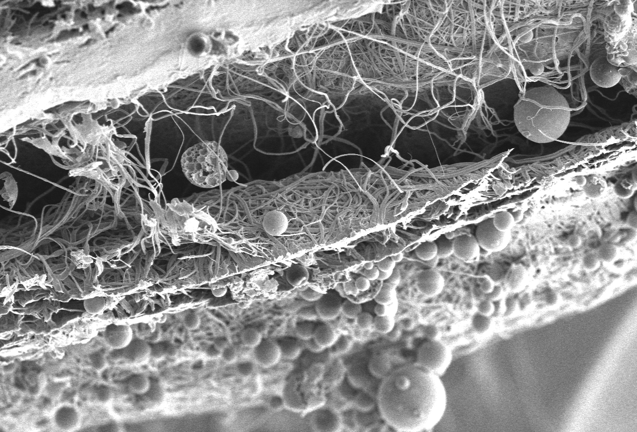 A microscopic image of a biodegradable graft with controlled drug delivery.
