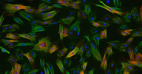 Vascular smooth muscle cells