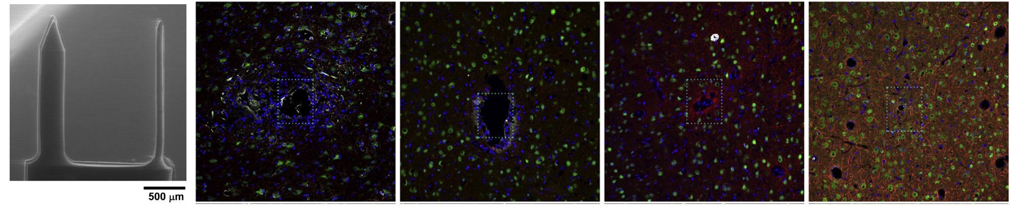 Chronic Tissue Response to Carboxymethyl Cellulose Based Dissolvable Insertion Needle for Ultra-Small Neural Probes