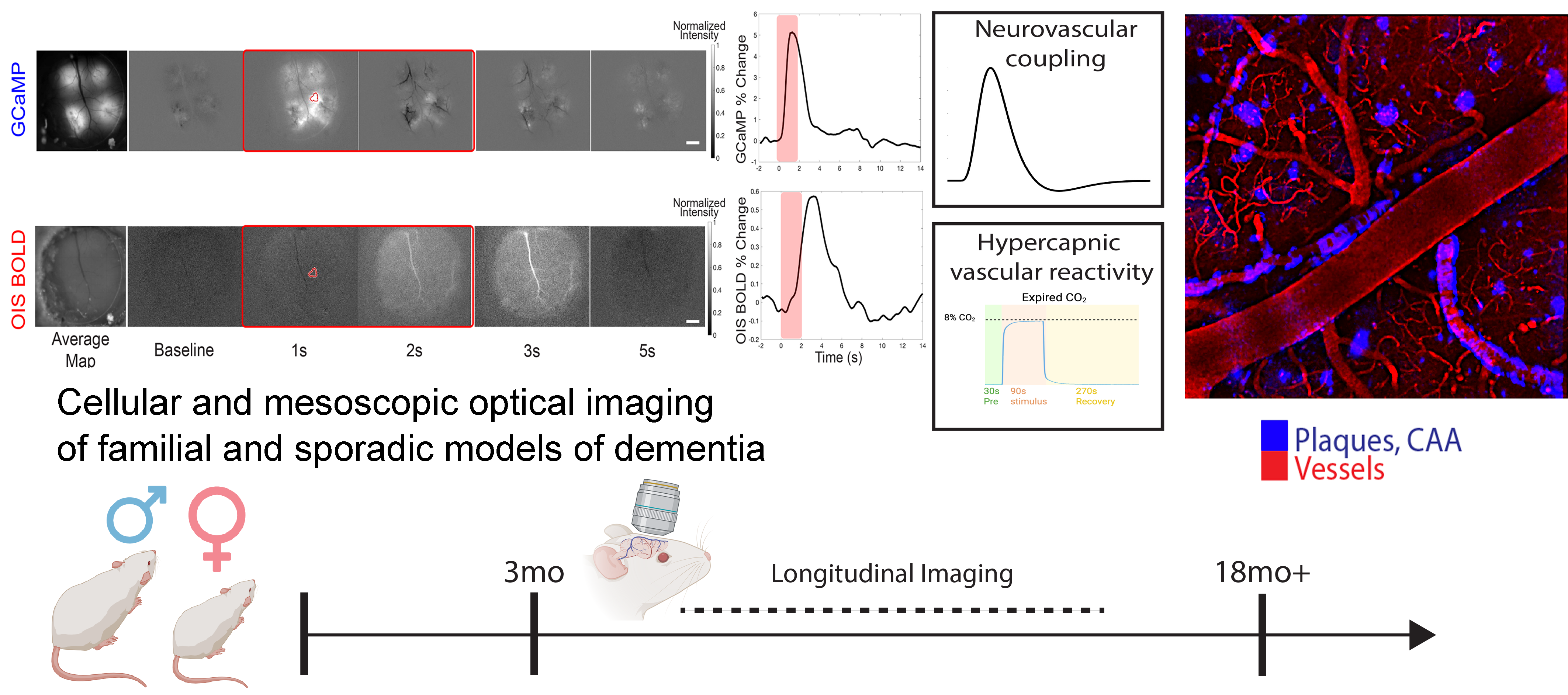 optical imaging of the brain in mouse models of Alzheimer’s disease 
